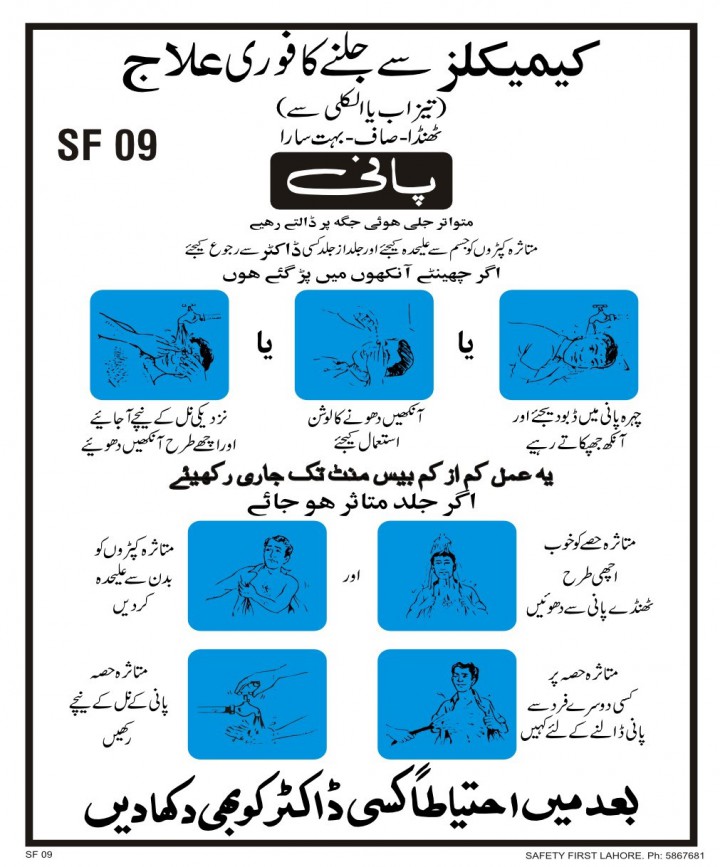 چمیکلز سے پہلے ہاتھ ضرور صاف کر لیں